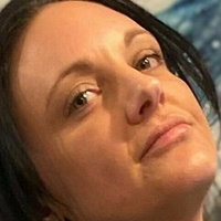 amputeedarling Desnuda