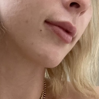 Askforindica Desnuda