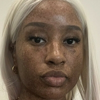 freckledn Desnuda