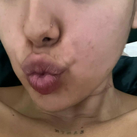notyourbabyt Desnuda