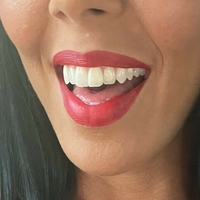 rachelstarrxxx Desnuda