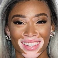 Winnie Harlow Desnuda